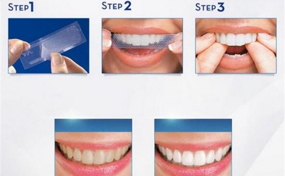 28pcs Strips Advanced Teeth