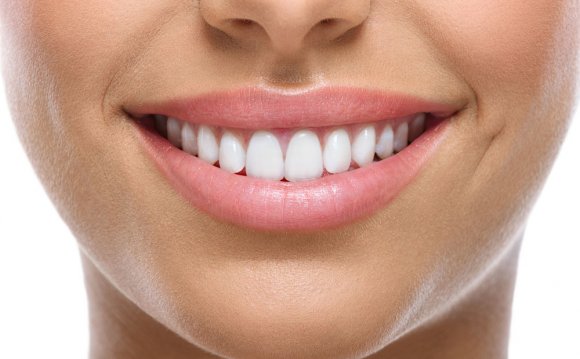 Teeth Whitening for Bonded