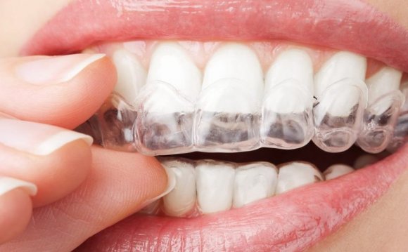 Cost Of Teeth Whitening