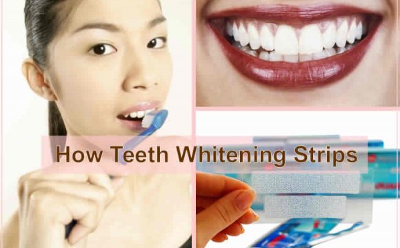 Home teeth whitening remedies