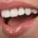 UV Teeth whitening gel