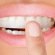 Dazzle Pro Teeth Whitening Reviews