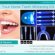 Dentist Teeth whitening gel