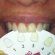 Dial a Smile Teeth Whitening Review