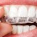 Home teeth whitening System