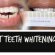 How to whiten teeth fast?