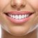 How to whitening Bonded teeth at home?