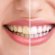Natural Home teeth whitening