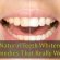 Natural teeth Whitening