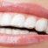 Teeth whitening strips do they work