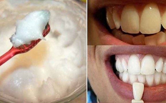 Home remedies to whitening teeth instantly