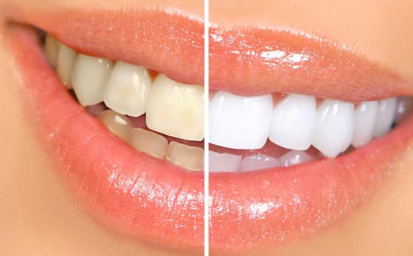 How To whiten teeth With Salt?