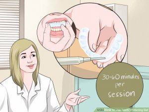 Image titled Use Teeth Whitening Gel Step 6