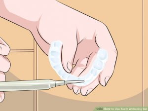 Image titled Use Teeth Whitening Gel Step 4