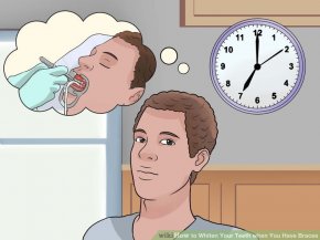 Image titled Whiten Your Teeth when You Have Braces Step 9