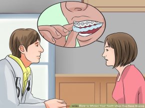 Image titled Whiten Your Teeth when You Have Braces Step 5