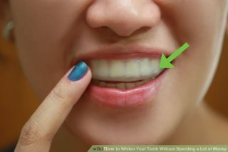 Image titled Whiten Your Teeth Without Spending a Lot of Money Step 2