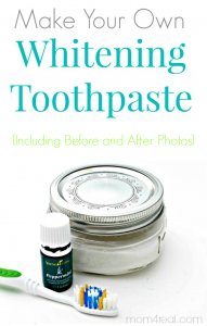 Make-Your-Own-Tooth-Whitening-Paste-with-Before-and-After-Photos-at-Mom-4-Real-Blog