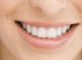 Best products for teeth whitening