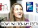 Best teeth whitening products