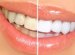 How To whiten teeth With Salt?
