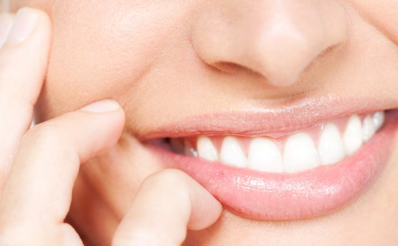 Best OTC teeth whitening products