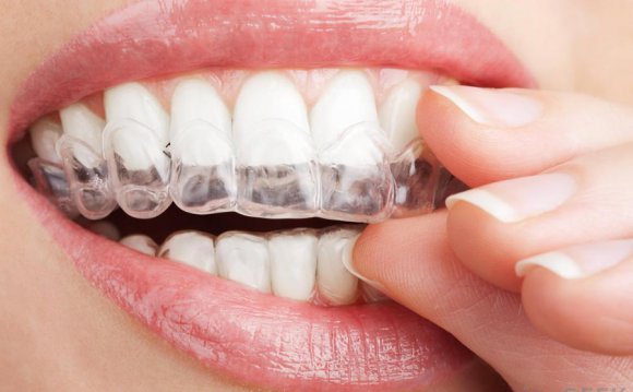 Home Teeth Whitening kits