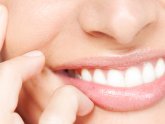 Best OTC teeth whitening products