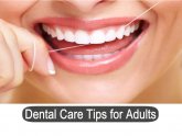 Cost professional Teeth Whitening