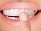 Dazzle Pro Teeth Whitening Reviews
