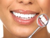 Does Laser Teeth whitening work