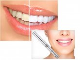 Smart Smile Teeth Whitening Reviews