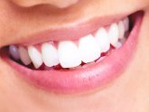 Smile kits Teeth Whitening