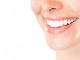 Teeth Whitening with veneers