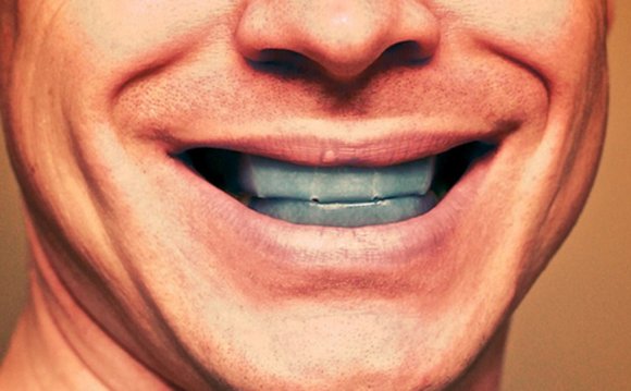 Where to Buy Teeth whitening gel?